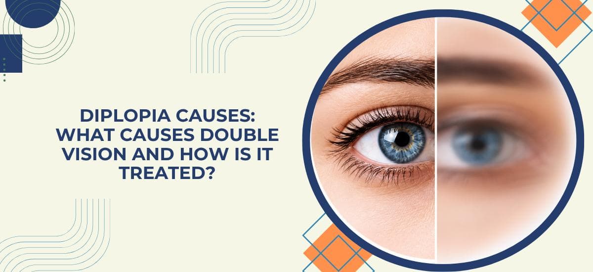 Diplopia Causes: What Causes Double Vision and How Is It Treated?