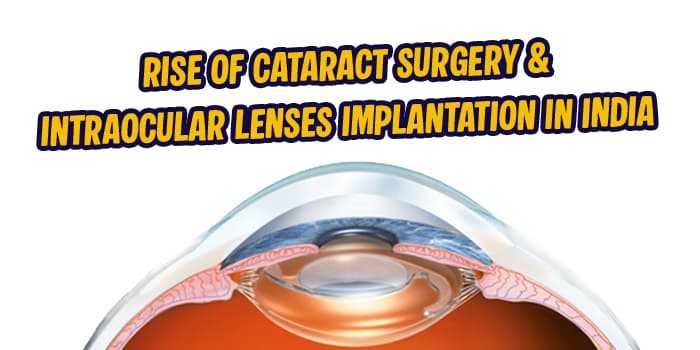 Rise of Cataract Surgery & Intraocular Lenses Implantation in India
