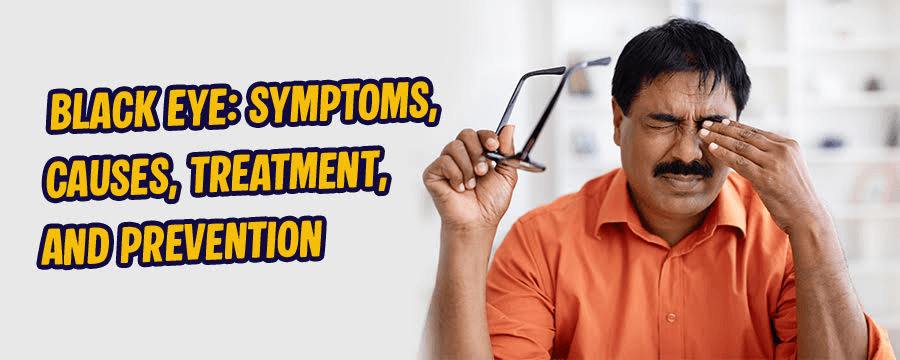Black Eye: Symptoms, Causes, Treatment, and Prevention