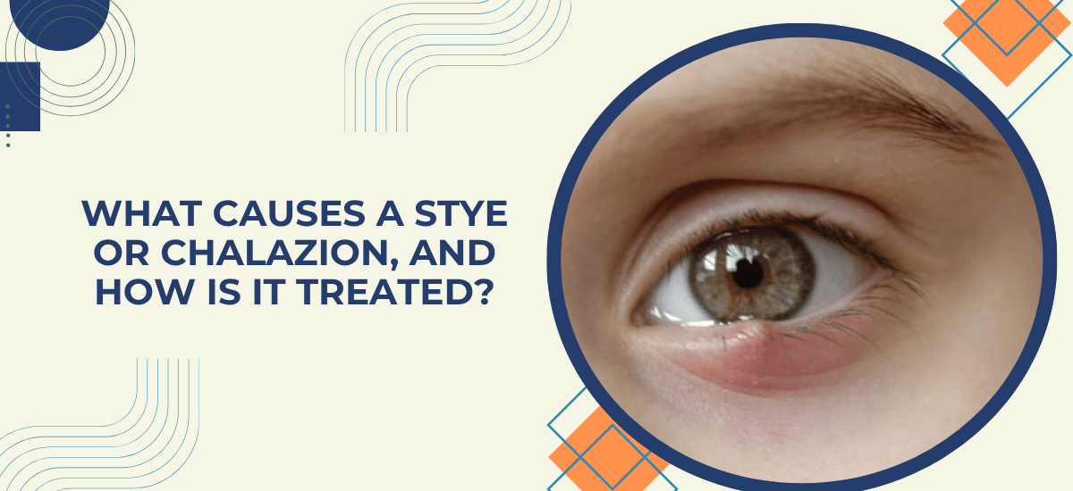 What Causes a Stye or Chalazion and How Is It Treated?