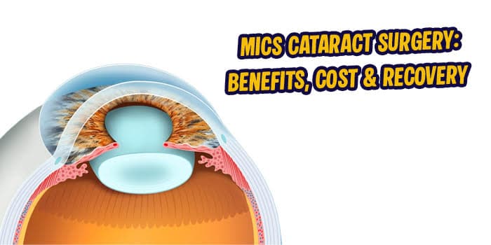MICS Cataract Surgery: Benefits, Cost & Recovery