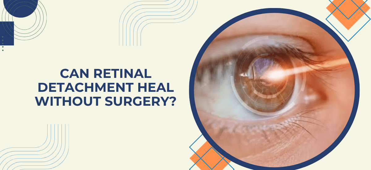 Can Retinal Detachment Be Fixed Without Surgery?