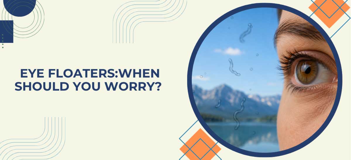 Eye Floaters: When Should You Worry?