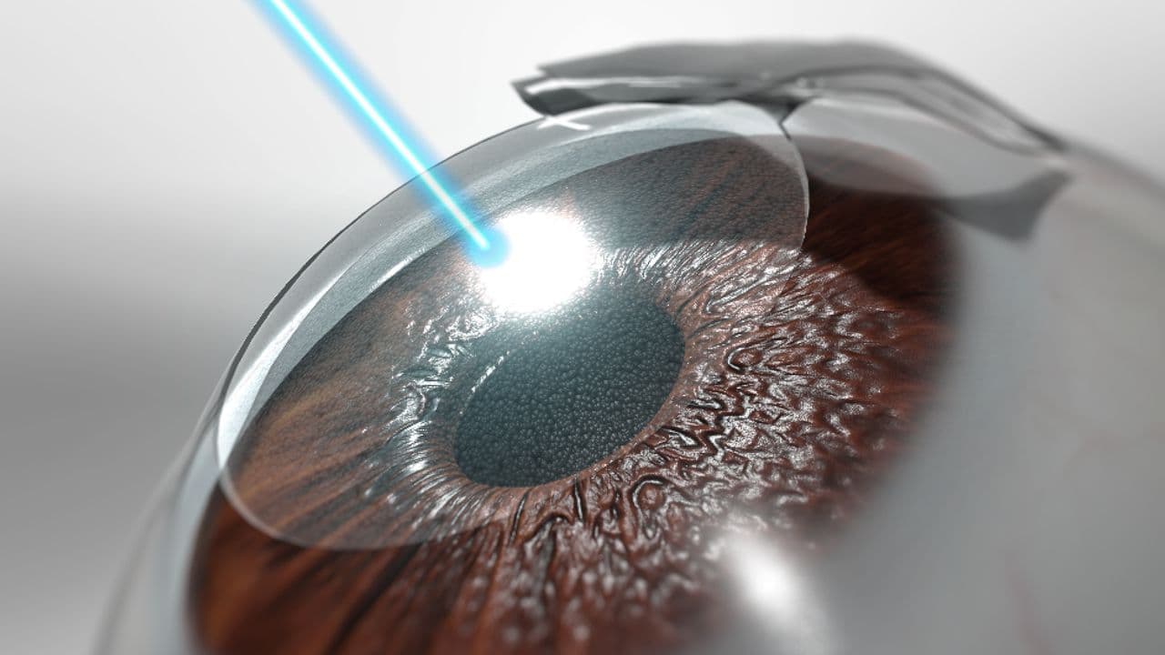 How Safe Is Lasik Surgery in Covid-19 ?