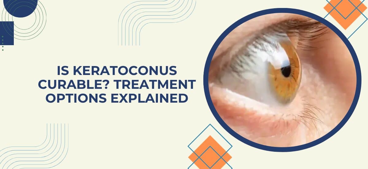 Is Keratoconus Curable? Treatment Options Explained