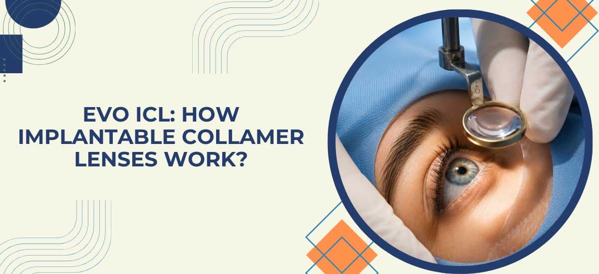 EVO ICL: How Implantable Collamer Lenses Work?
