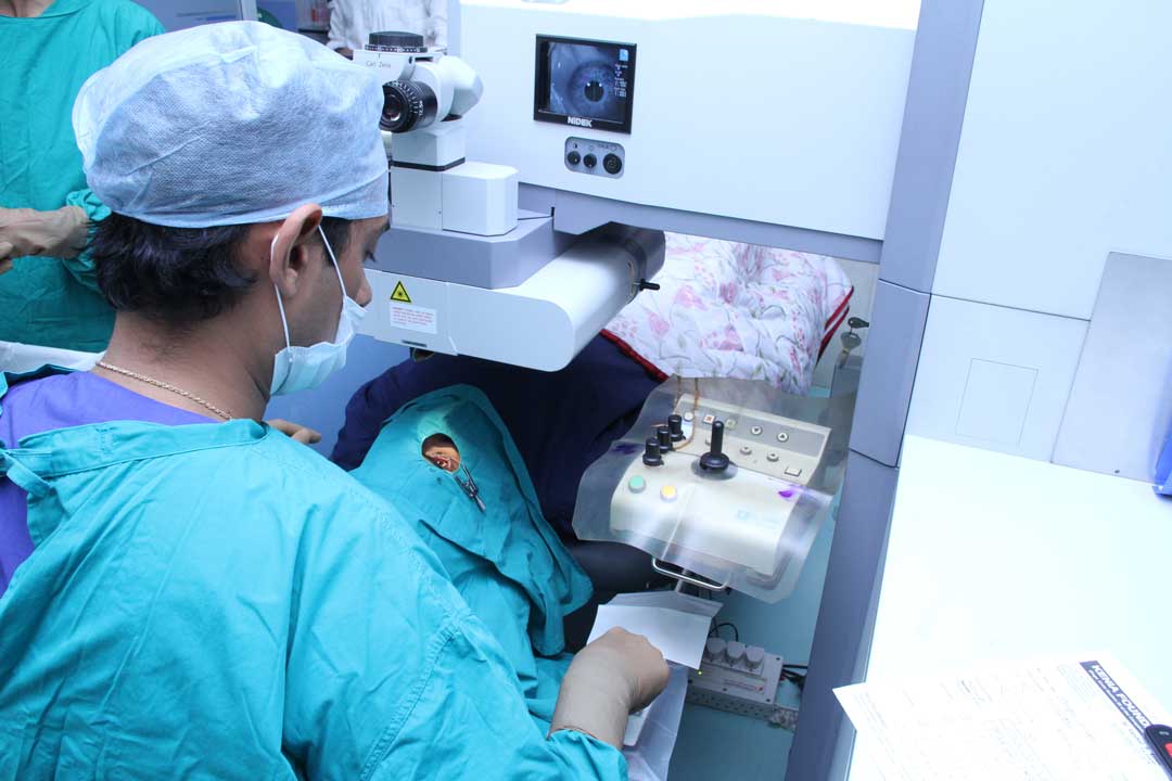 LASIK eye surgery in