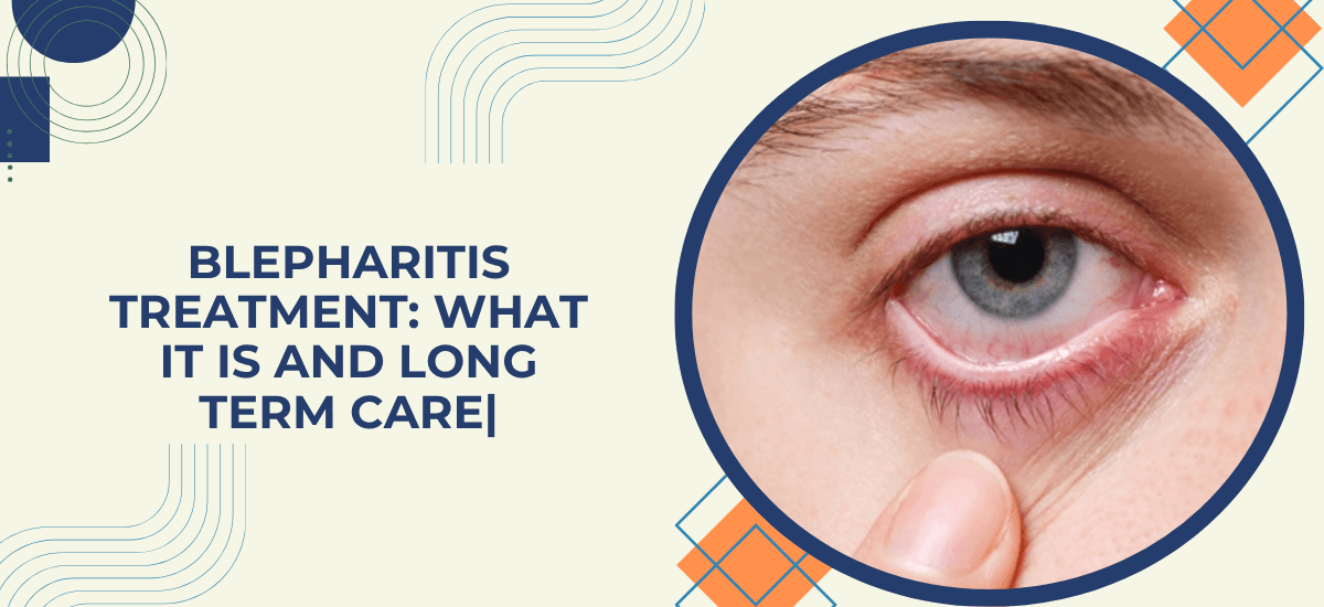 What Is Blepharitis and How Do You Treat It Long Term?