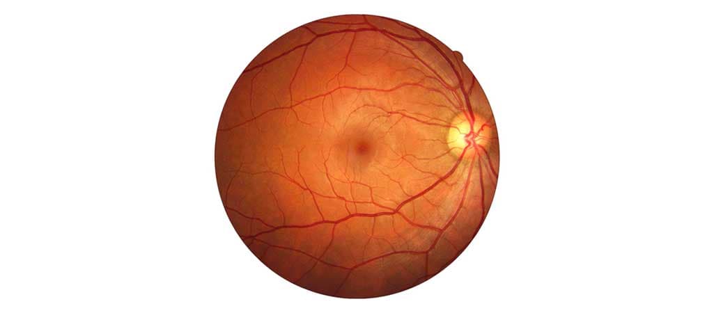 Retina Treatment in