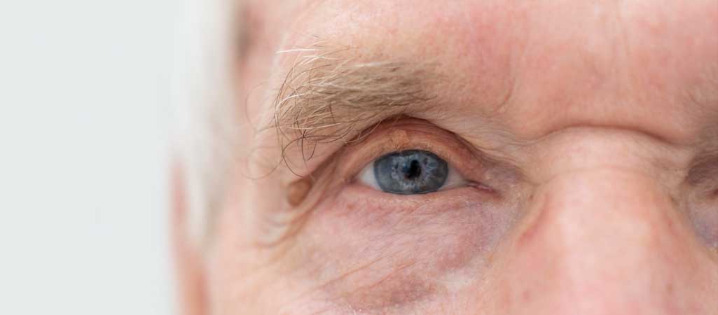 Diagnosis of Glaucoma in