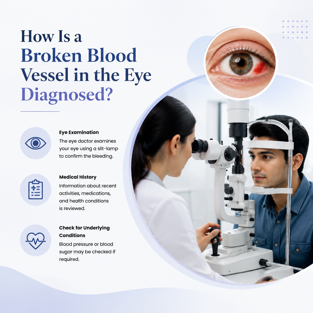 Diagnosis of a broken blood vessel in the eye